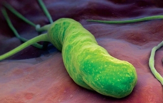 helicobacter-pylori